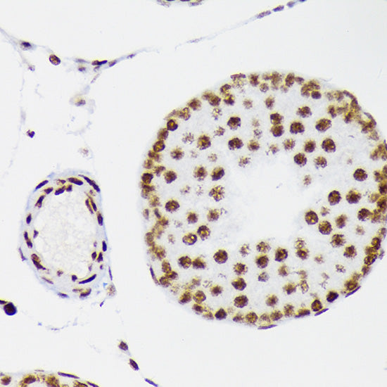 DNA Ligase I Rabbit mAb