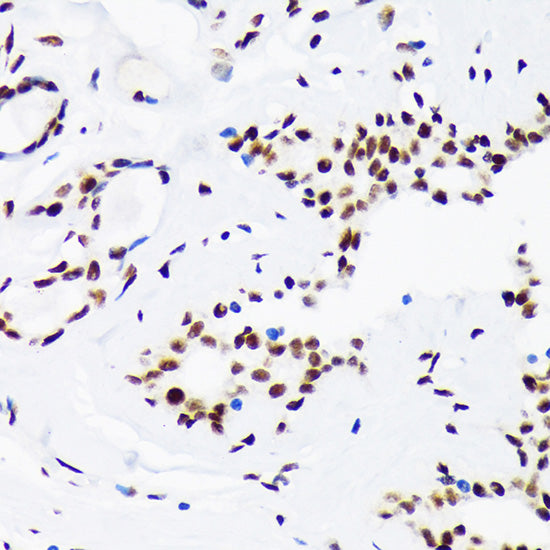 DNA Ligase I Rabbit mAb