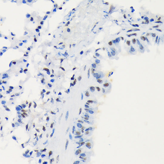 DNA Ligase I Rabbit mAb