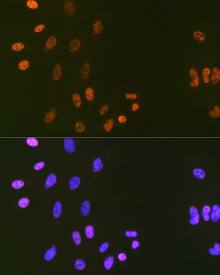 DNA Ligase I Rabbit mAb