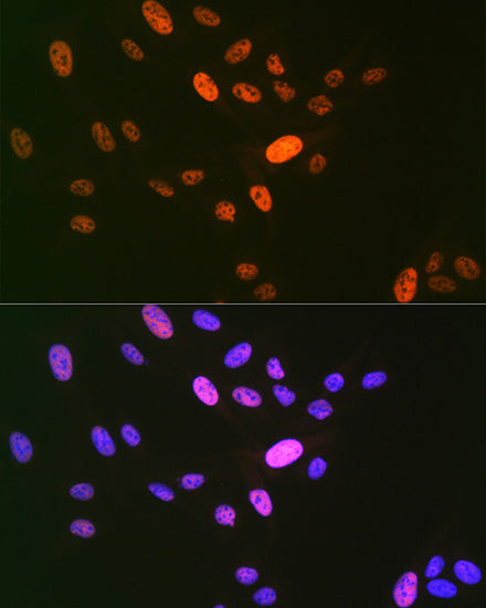 DNA Ligase I Rabbit mAb