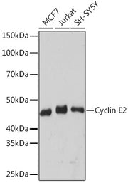 Cyclin E2 Rabbit mAb