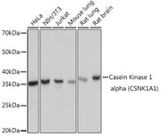 Casein Kinase 1 alpha (CSNK1A1) Rabbit mAb