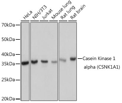 Casein Kinase 1 alpha (CSNK1A1) Rabbit mAb