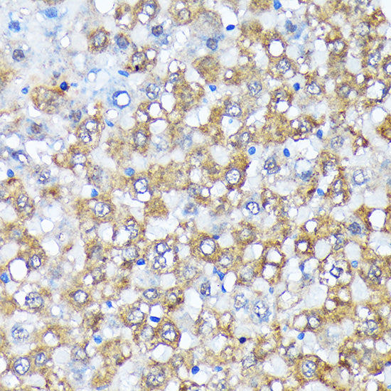 Casein Kinase 1 alpha (CSNK1A1) Rabbit mAb