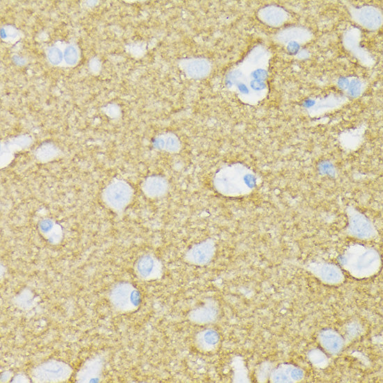 STXBP1 Rabbit mAb