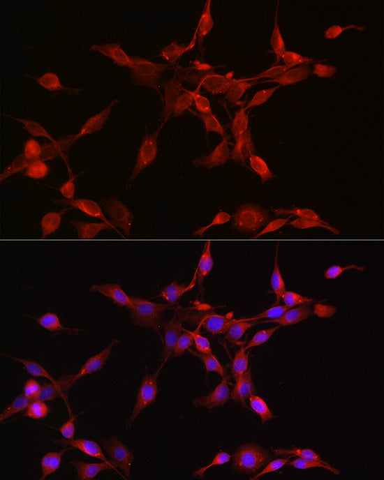 ORP1 Rabbit mAb