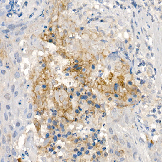 CNTN4 Rabbit mAb