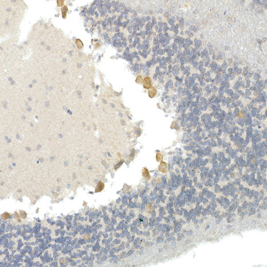 CNTN4 Rabbit mAb