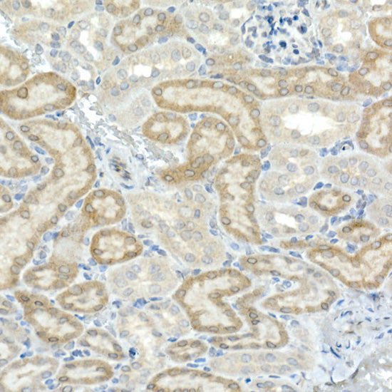 CNTN4 Rabbit mAb