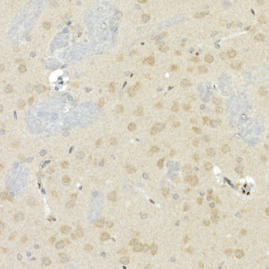 CNTN4 Rabbit mAb