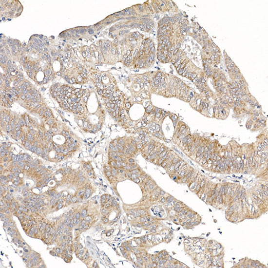 MUTA Rabbit mAb