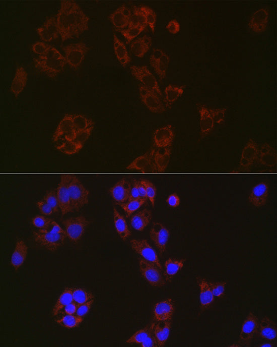 MUTA Rabbit mAb