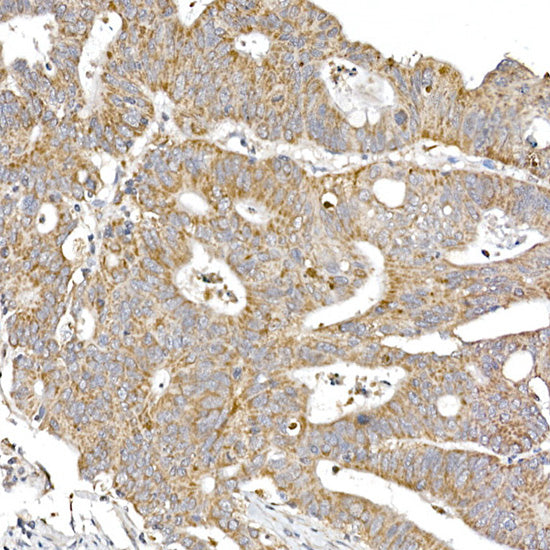 SAMM50 Rabbit mAb