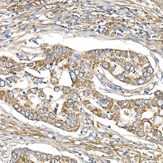 SAMM50 Rabbit mAb