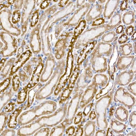 SAMM50 Rabbit mAb