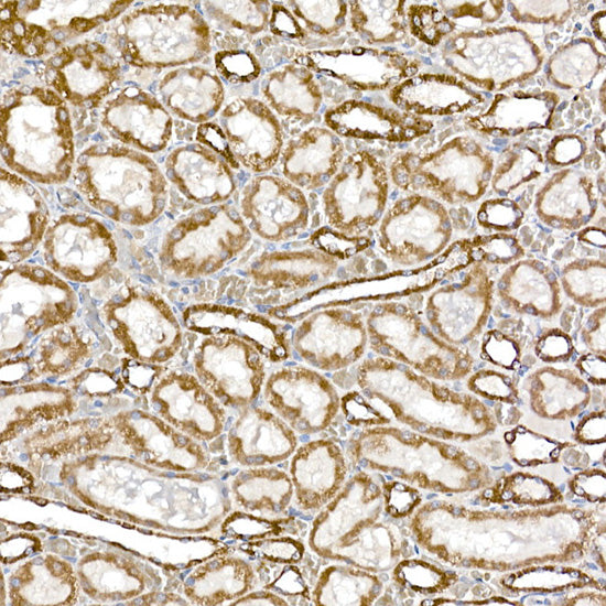 SAMM50 Rabbit mAb