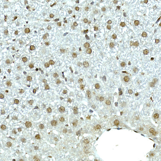 NOP10 Rabbit mAb