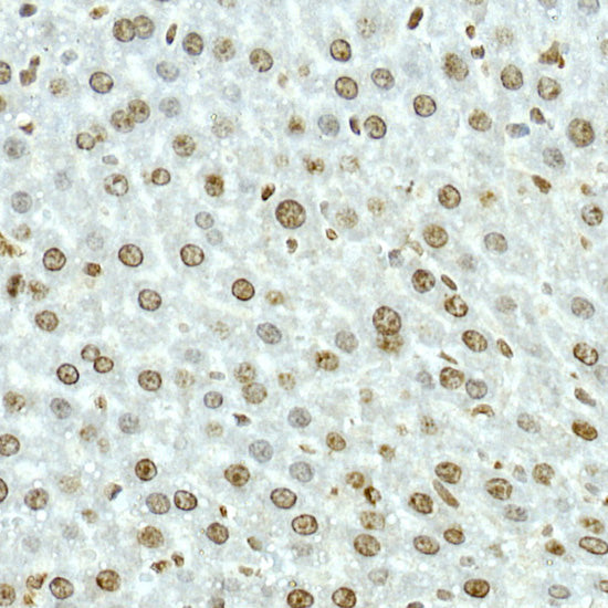 NOP10 Rabbit mAb