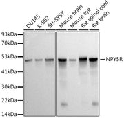 NPY5R Rabbit mAb