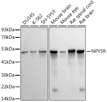 NPY5R Rabbit mAb