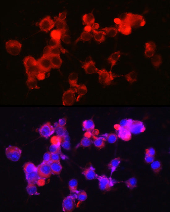 NPY5R Rabbit mAb
