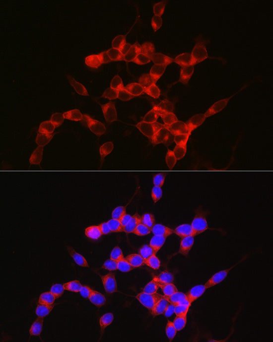 NPY5R Rabbit mAb