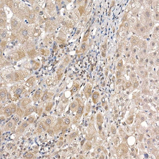 DCAF7 Rabbit mAb