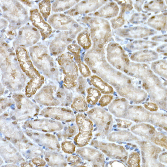 DCAF7 Rabbit mAb