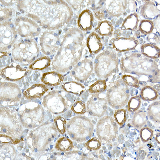 DCAF7 Rabbit mAb