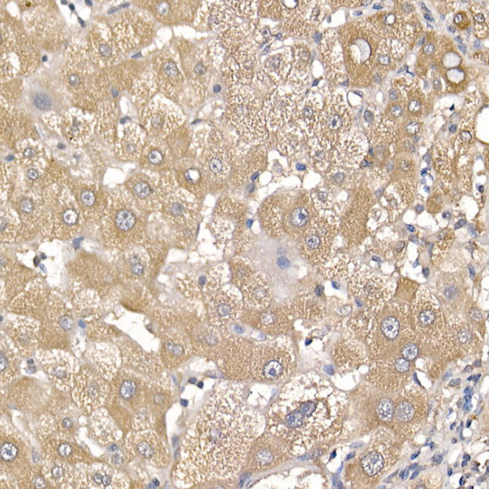 IL11RA Rabbit mAb