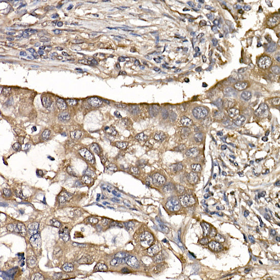 IL11RA Rabbit mAb