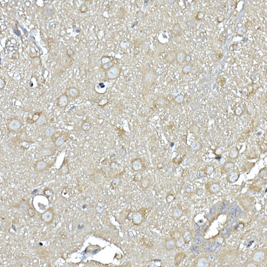 IL11RA Rabbit mAb