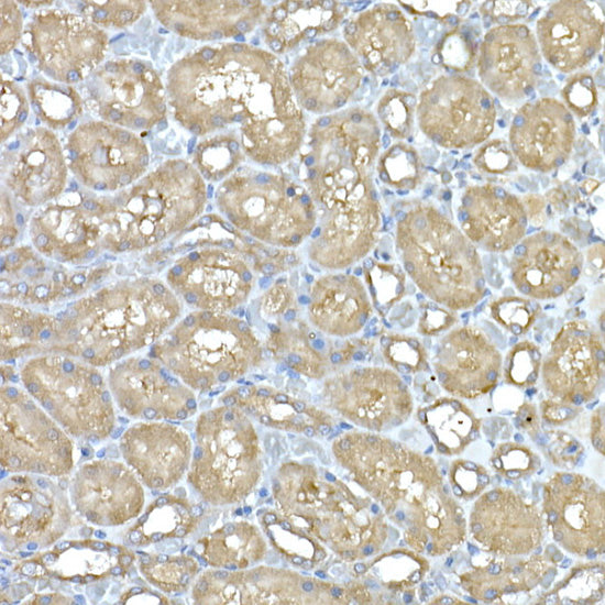 IL11RA Rabbit mAb