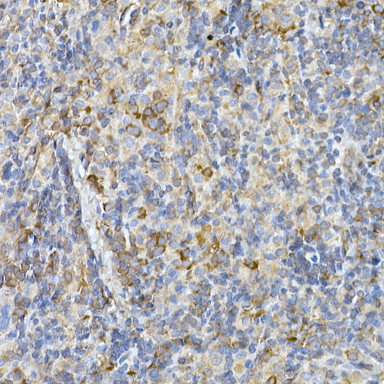 IL11RA Rabbit mAb