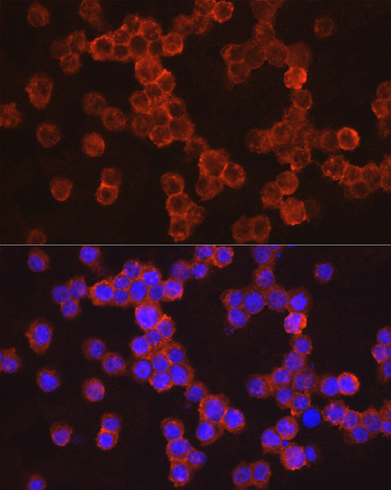IL11RA Rabbit mAb