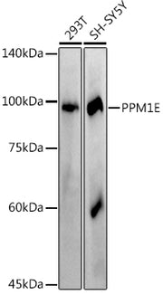 PPM1E Rabbit mAb