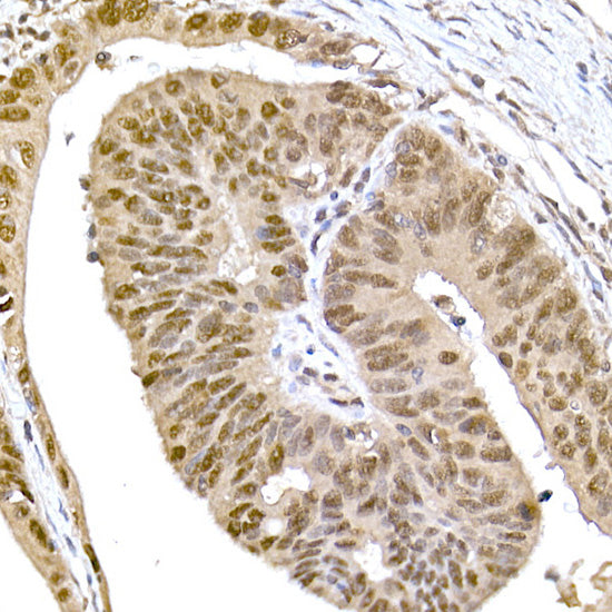 SR protein repeat Rabbit mAb