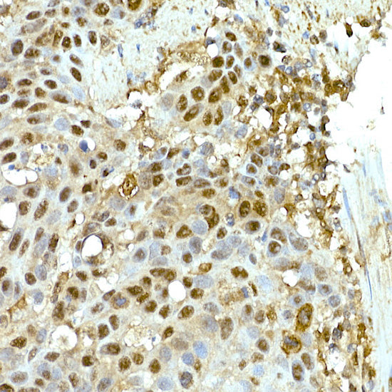 SR protein repeat Rabbit mAb