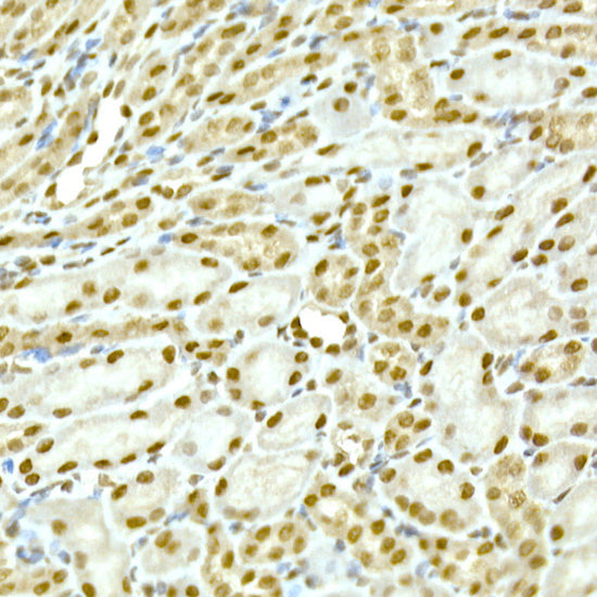 SR protein repeat Rabbit mAb