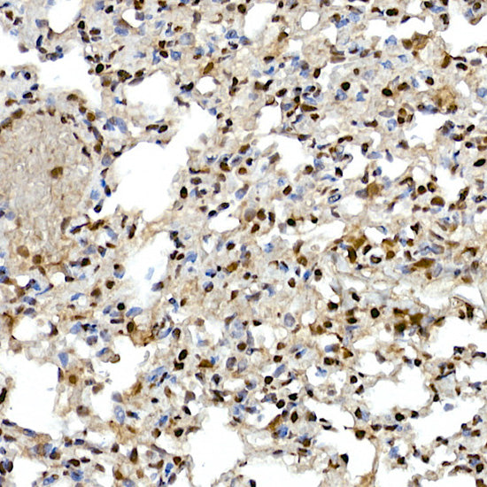 SR protein repeat Rabbit mAb