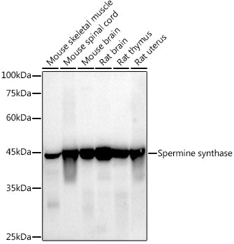 Spermine synthase Rabbit mAb
