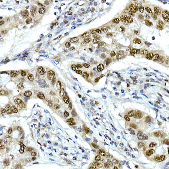 TAF15 Rabbit mAb