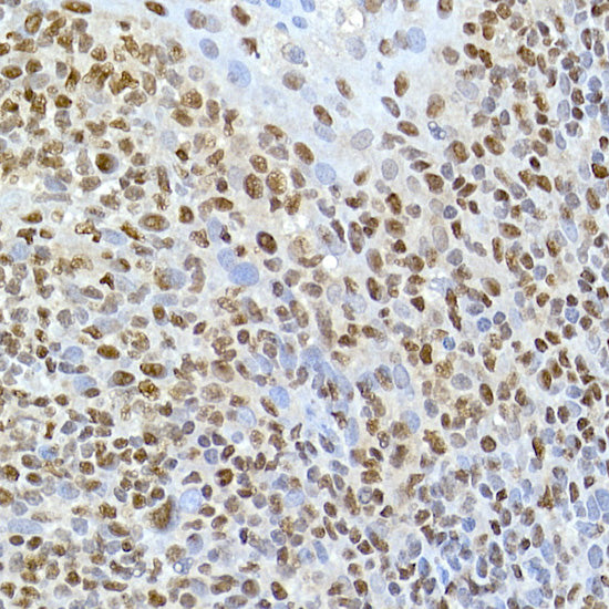 TAF15 Rabbit mAb