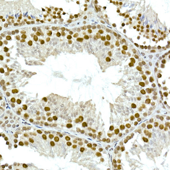 TAF15 Rabbit mAb