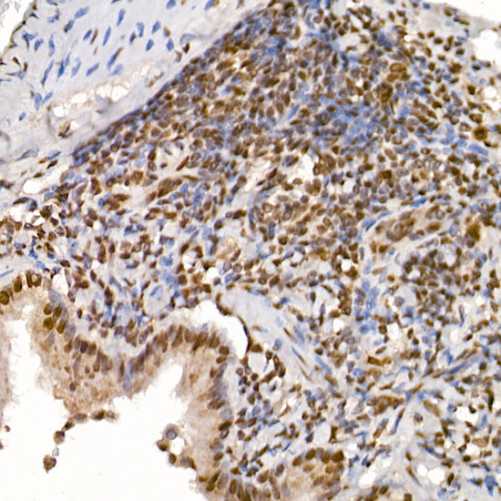 TAF15 Rabbit mAb