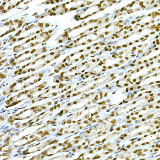 TAF15 Rabbit mAb
