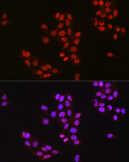 TAF15 Rabbit mAb