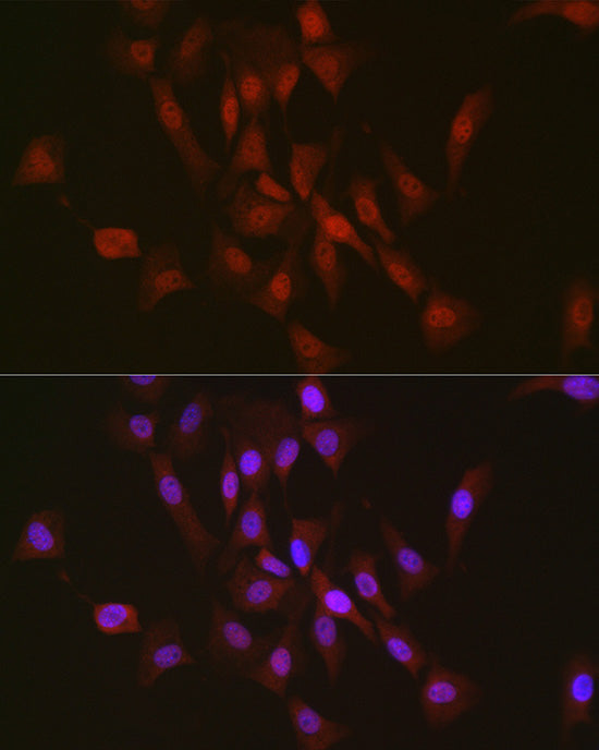 TAF15 Rabbit mAb