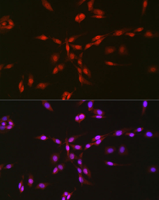 TAF15 Rabbit mAb
